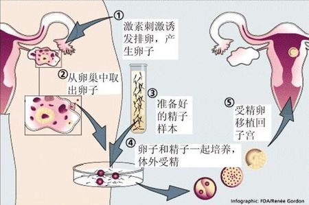 助孕全国招募孕妈志愿者生殖中心